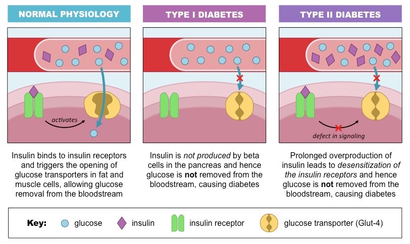 diabetes