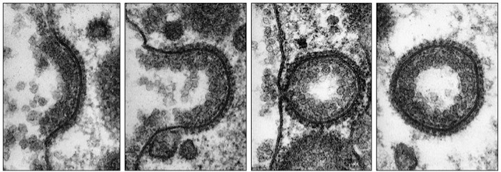 endocytosis EM