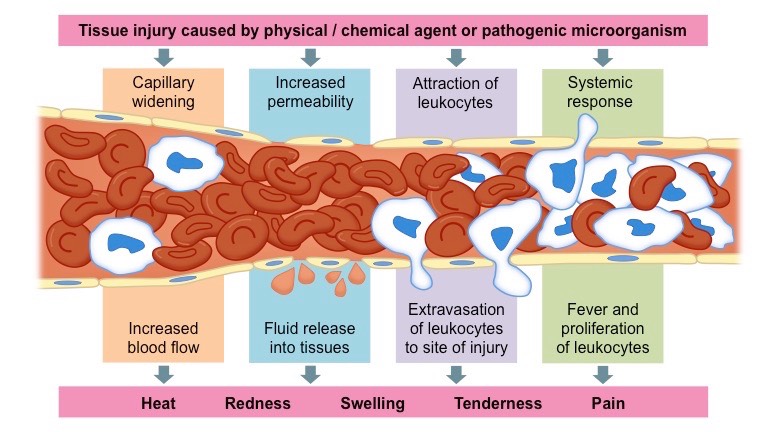 inflammation