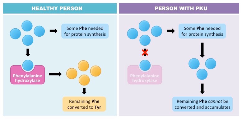 PKU