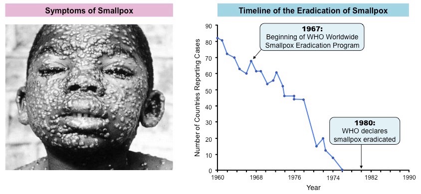 smallpox