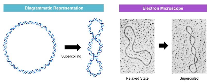 supercoiling