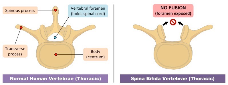 vertebrae