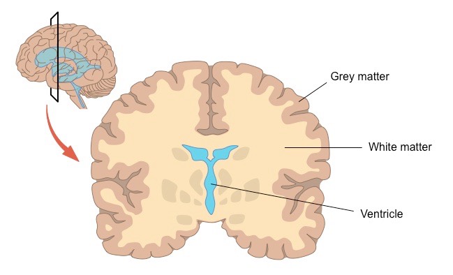 white vs grey matter